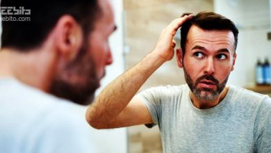 تصویر از ریزش مو در رژیم کتوژنیک ؛ علت ، روش جلوگیری و درمان